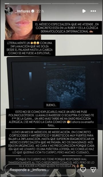 matramoros-360x620-1