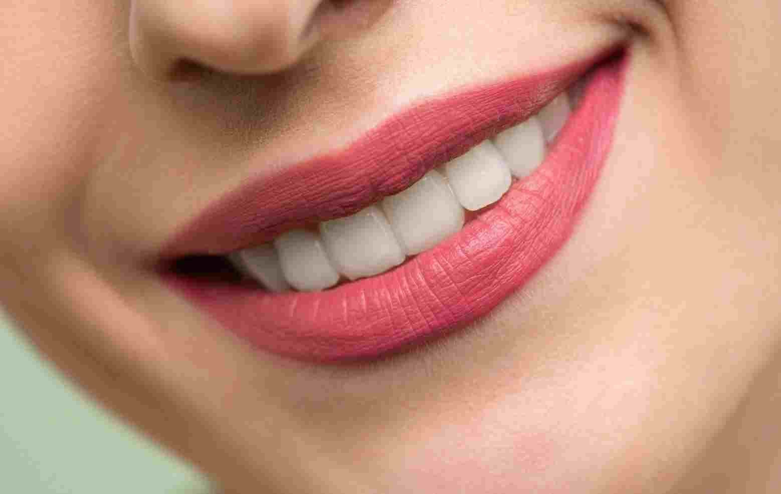 labios